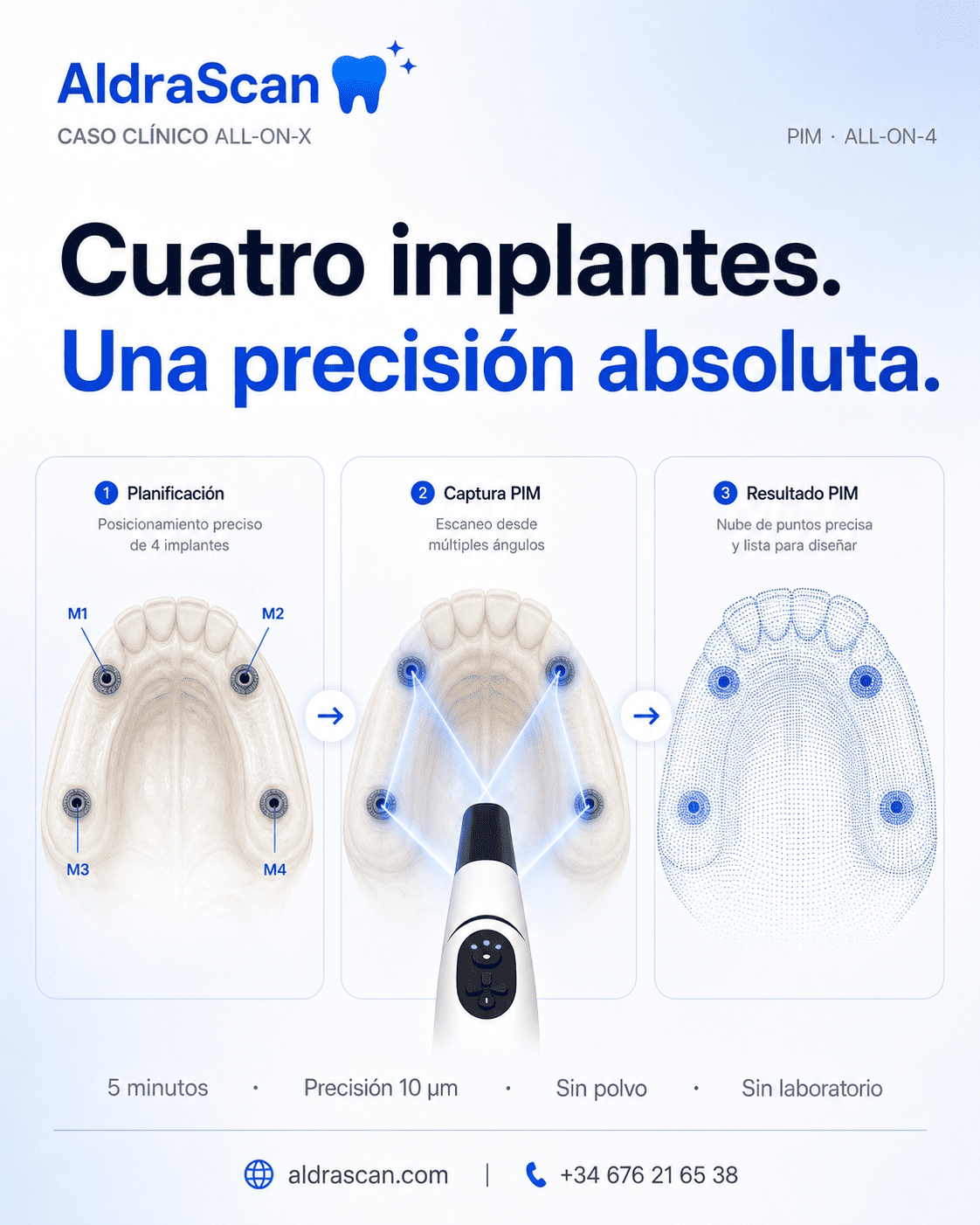 Freedom Air: caso clínico All-on-4 con tecnología PIM